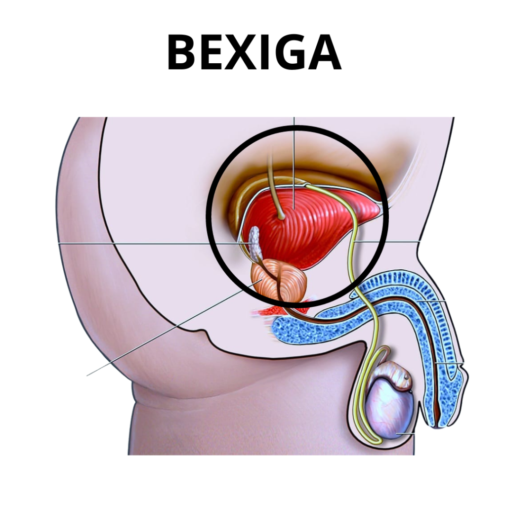 img-bexiga dr andres