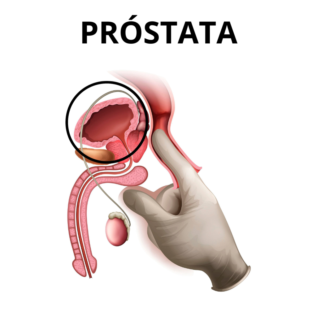 img prostata dr andres